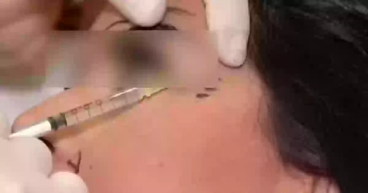 عمليات تجميل